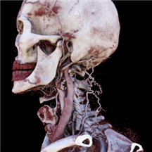 SurgicalAR.png SurgicalAR.png